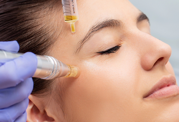 Dermapen con Exosomas