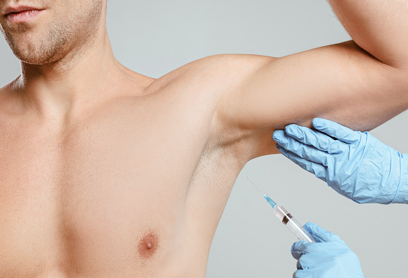 Hiperhidrosis
