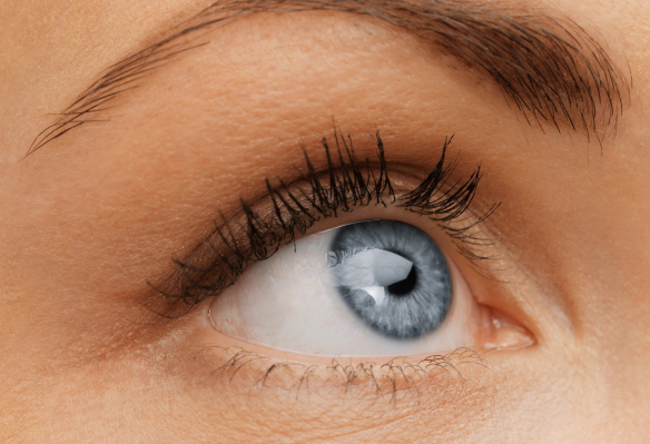 Ojeras