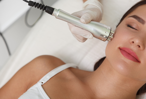 Radiofrecuencia Facial